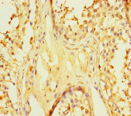 Anti-ZNF252P-AS1