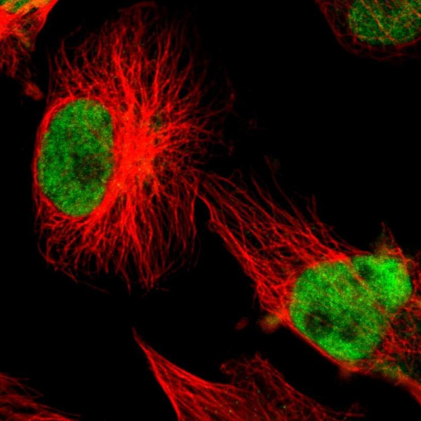 Anti-XRCC1