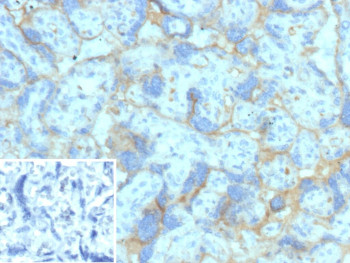 Anti-NECTIN4 / Poliovirus receptor related 4, clone NECTIN4/13438R