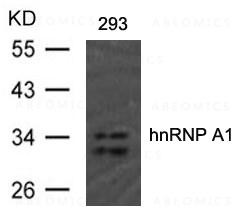 Anti-hnRNP A1 (Ab-192)
