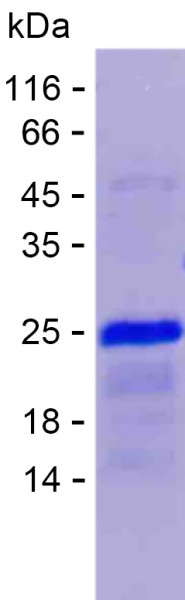 Recombinant Human ZNF260 Protein