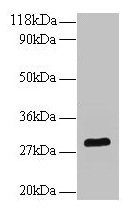 Anti-Bdnf