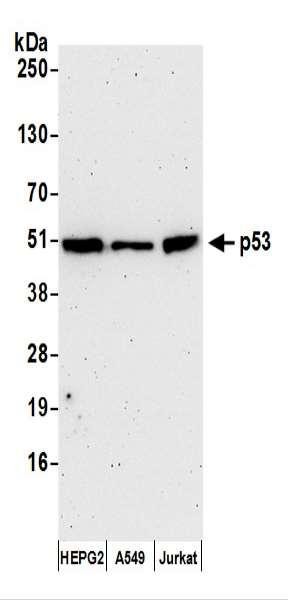 Anti-p53 Monoclonal