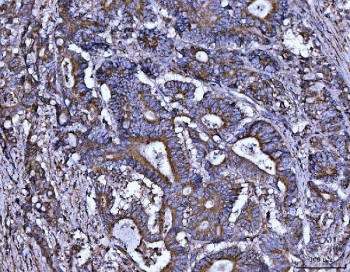 Anti-ALDH1A2