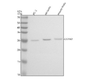 Anti-GSTM2 / Glutathione S-transferase Mu 2
