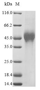 V-set and immunoglobulin domain-containing protein 1 (VSIG1), partial, human, recombinant