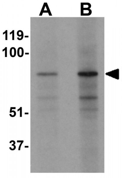 Anti-EZH1