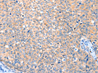 Anti-VANGL1
