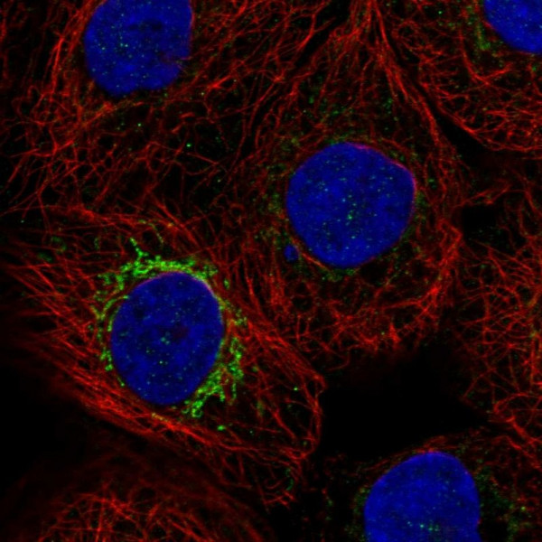 Anti-MPP2