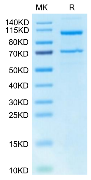 Human Complement C5 Protein