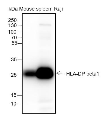 Anti-Recombinant HLA-DPB1, clone A250