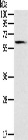 Anti-SLC45A3