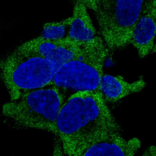 Anti-RPL27A