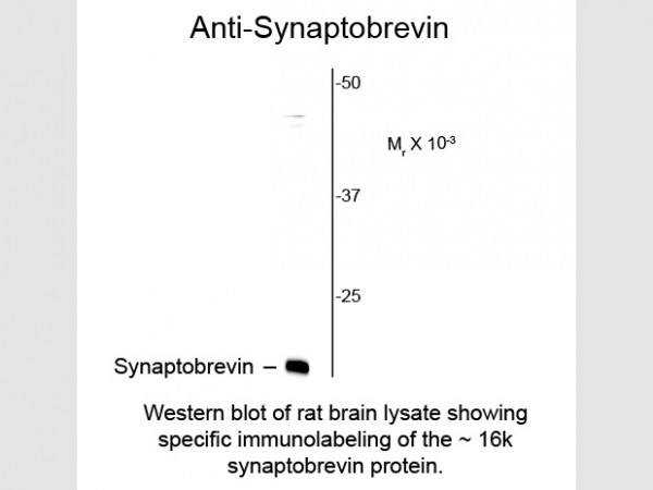 Anti-Synaptobrevin (VAMP), clone SP10