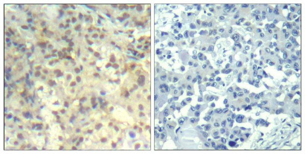 Anti-phospho-Cofilin 1 (Tyr139)