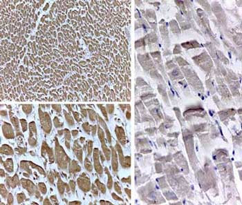 Anti-PPARd, IN (Peroxisome Proliferator Activated Receptor, delta)