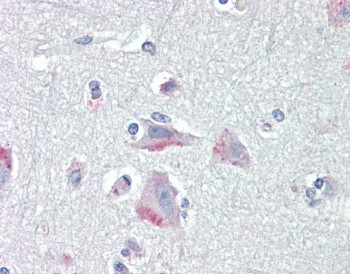 Anti-CRF1