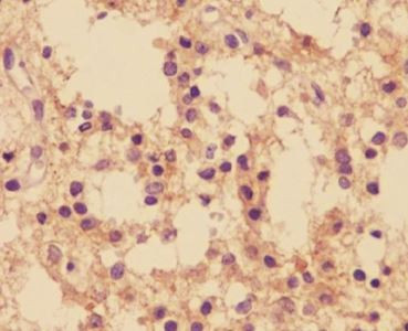 Anti-phospho-TrkB (Tyr817)