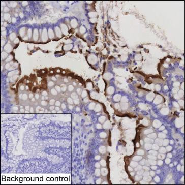 Anti-CDHR5