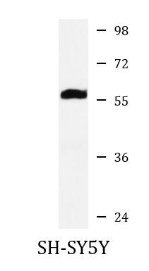Anti-NF66 / alpha Internexin