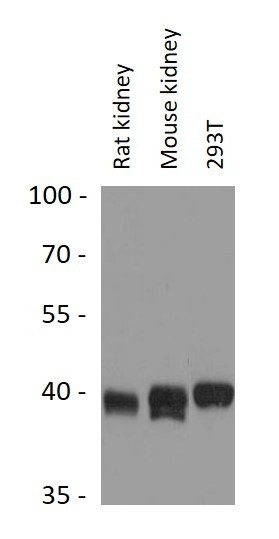 Anti-IDH3B