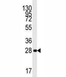 Anti-AMPK beta 1 / PRKAB1