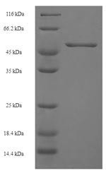Chitinase domain-containing protein 1 (CHID1), human, recombinant