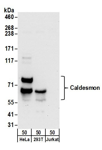Anti-Caldesmon
