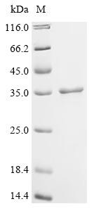 Cell division cycle and apoptosis regulator protein 1 (CCAR1), partial, human, recombinant