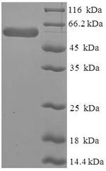 Leukocyte elastase inhibitor (SERPINB1), human, recombinant