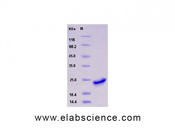 Recombinant Human SHH / Sonic hedgehog Protein (aa 1-197, His tag)