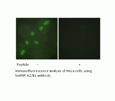 Anti-hnRNP A2/B1