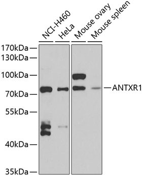 Anti-ANTXR1