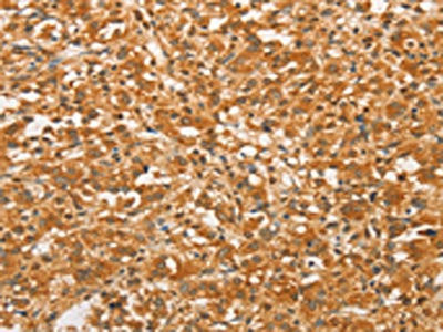 Anti-BCL2L14