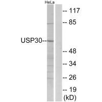 Anti-USP30