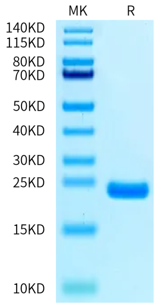Biotinylated Cynomolgus IL-1 Beta/IL-1F2 Protein
