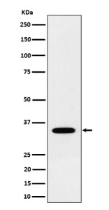 Anti-NTHL1 / Endonuclease III like protein 1, clone 30N17