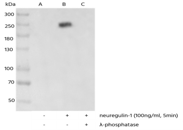 Anti-Phospho-HER3/ErbB3 (Tyr1289) Monoclonal Recombinant Antibody
