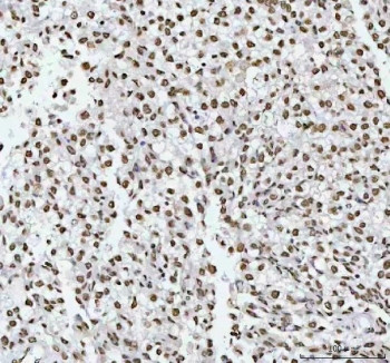 Anti-RNA-binding motif protein 3 / RBM3, clone 29R08