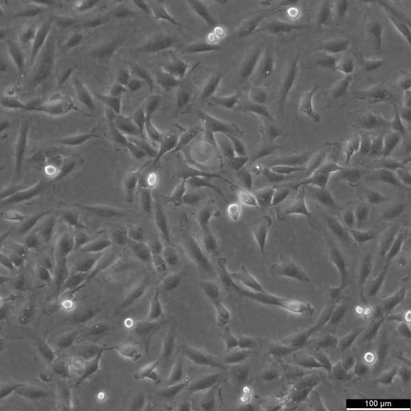 KTC-1 Cells