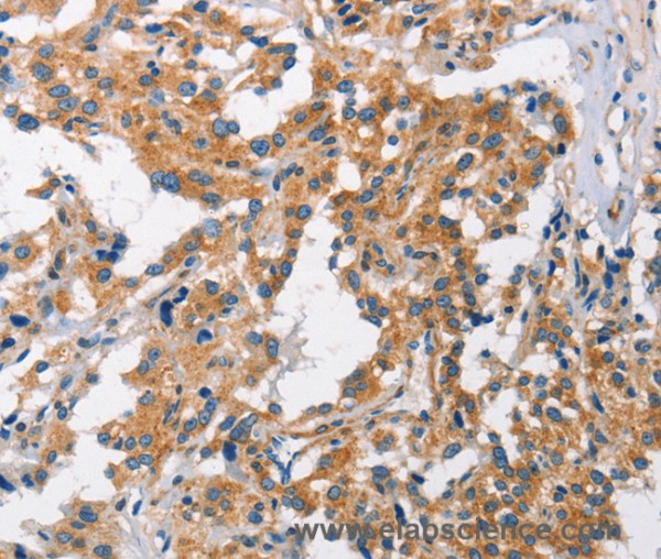 Anti-CHMP1A