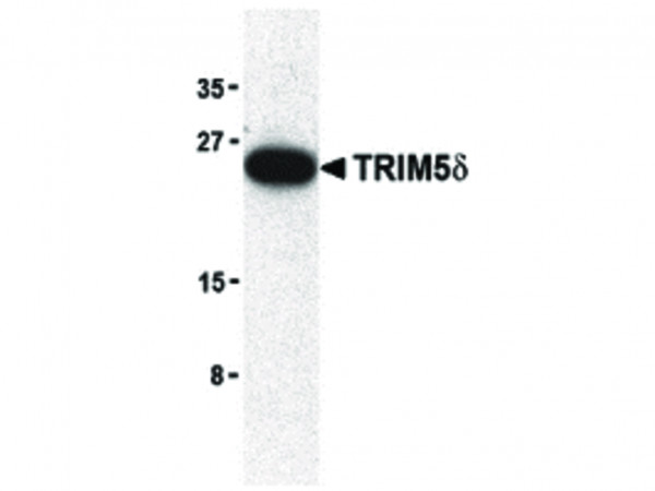 Anti-TRIM5 delta
