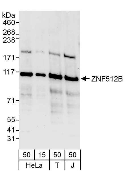 Anti-ZNF512B