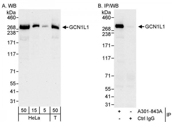 Anti-GCN1L1