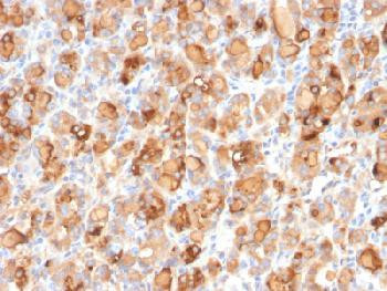 Anti-Thyroglobulin (Thyroidal Cell Marker) Recombinant Mouse Monoclonal Antibody (clone:r2H11)