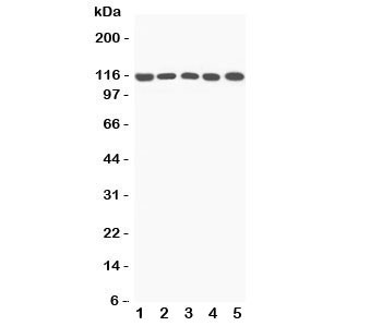 Anti-C5a Complement 5a