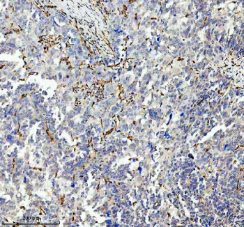 Anti-GIMAP4 / GTPase IMAP family member 4