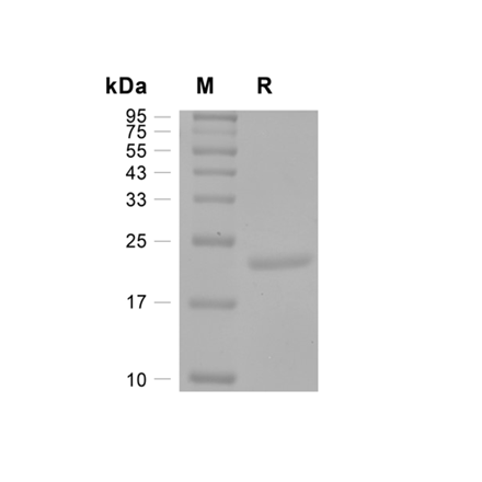 IL-6 (Interleukin 6) Recombinant (Human)
