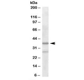 Anti-ARPC1B