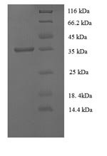 Tissue factor pathway inhibitor (TFPI), rabbit, recombinant
